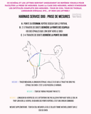 Harnais X-Back pour chien d'assistance en BioThane doublé mousse, modèle déposé Atelier des Toutous